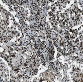 ACTL6A Rabbit Polyclonal Antibody