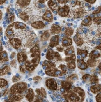 ADA Rabbit Polyclonal Antibody
