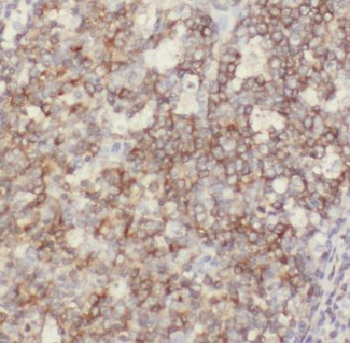 ADAMDEC1 Rabbit Polyclonal Antibody