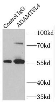 ADAMTSL4 Rabbit Polyclonal Antibody