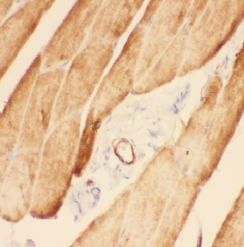 ADAMTSL4 Rabbit Polyclonal Antibody