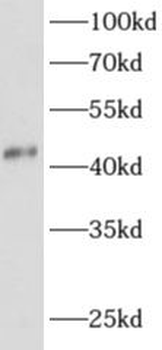 ADAP1 Rabbit Polyclonal Antibody