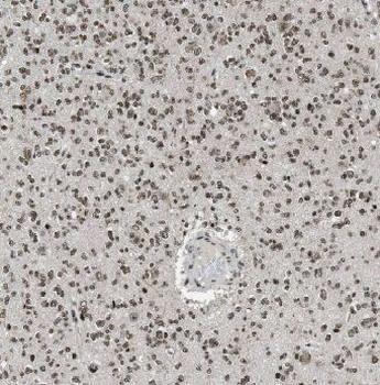 ADAP1 Rabbit Polyclonal Antibody