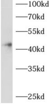 ADAP2 Rabbit Polyclonal Antibody