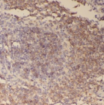 ADAP2 Rabbit Polyclonal Antibody