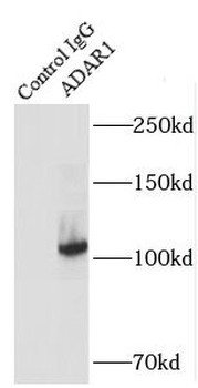 ADAR Rabbit Polyclonal Antibody