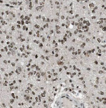 ADAR Rabbit Polyclonal Antibody