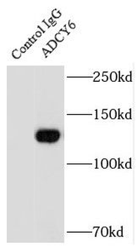 ADCY6 Rabbit Polyclonal Antibody