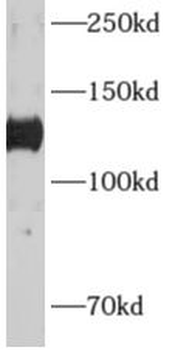ADCY6 Rabbit Polyclonal Antibody