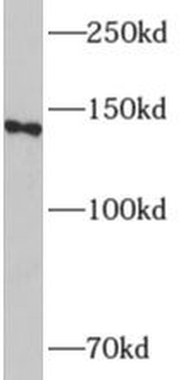 ADCY8 Antibody