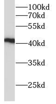 ADH4 Antibody