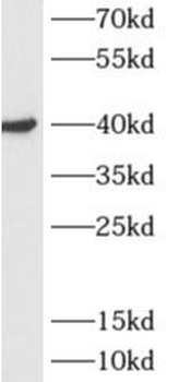 ADH6 Rabbit Polyclonal Antibody