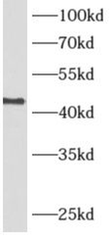 ADH7 Rabbit Polyclonal Antibody