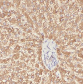 ADH7 Rabbit Polyclonal Antibody