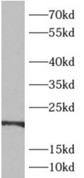 ADI1 Rabbit Polyclonal Antibody