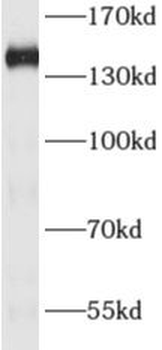 ADNP Rabbit Polyclonal Antibody