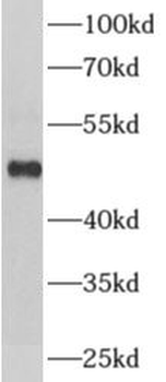 ADRA1B Rabbit Polyclonal Antibody