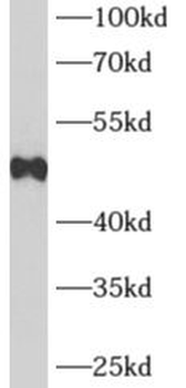 ADRB2 Rabbit Polyclonal Antibody