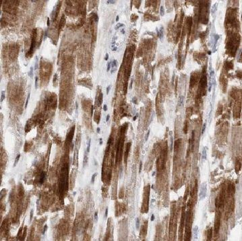 ADRB2 Rabbit Polyclonal Antibody