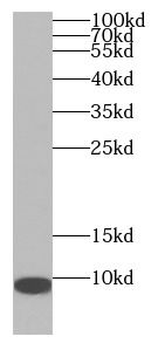 ADM Rabbit Polyclonal Antibody
