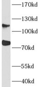 AFAP1 Antibody