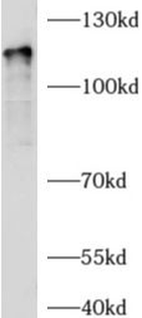AGAP2 Rabbit Polyclonal Antibody