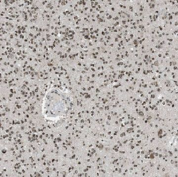 AGAP2 Rabbit Polyclonal Antibody