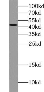AGER Antibody