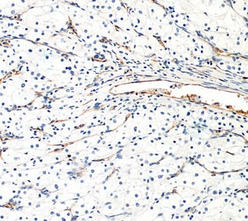 AGER Antibody