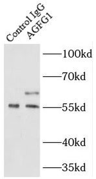 AGFG1 Rabbit Polyclonal Antibody