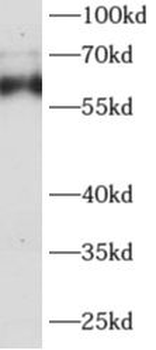 AGFG1 Rabbit Polyclonal Antibody