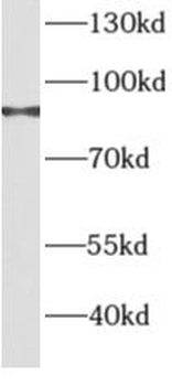 AGGF1 Rabbit Polyclonal Antibody