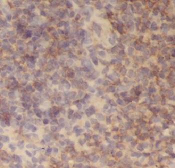 AGGF1 Rabbit Polyclonal Antibody