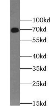 ACAN Rabbit Polyclonal Antibody