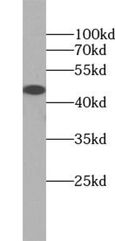 AGTR1 Rabbit Polyclonal Antibody