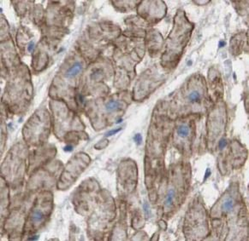 AGTR1 Rabbit Polyclonal Antibody