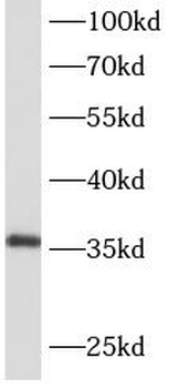 AIDA Rabbit Polyclonal Antibody