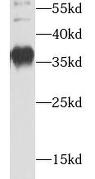 AIP Rabbit Polyclonal Antibody
