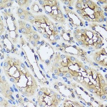 AIP Rabbit Polyclonal Antibody