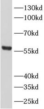 AJUBA Rabbit Polyclonal Antibody