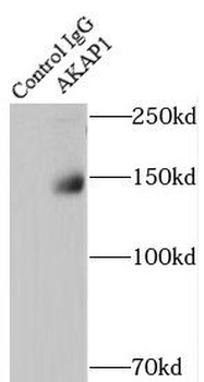 AKAP1 Rabbit Polyclonal Antibody