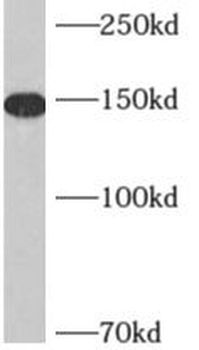 AKAP1 Rabbit Polyclonal Antibody