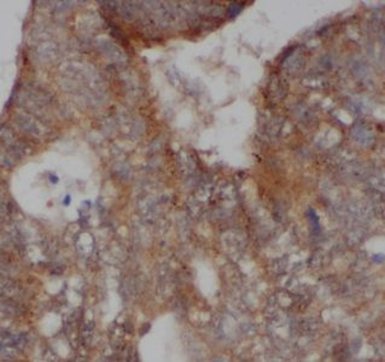 AKAP1 Rabbit Polyclonal Antibody