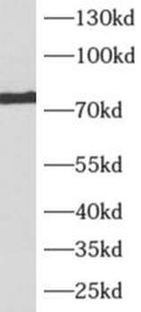 AKAP10 Rabbit Polyclonal Antibody