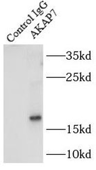 AKAP7 Rabbit Polyclonal Antibody