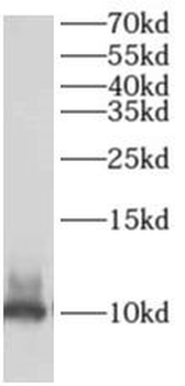 AKAP7 Rabbit Polyclonal Antibody