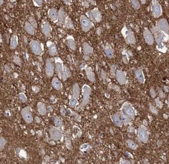 AKAP7 Rabbit Polyclonal Antibody