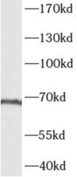 AKNA Rabbit Polyclonal Antibody