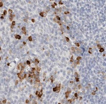 AKNA Rabbit Polyclonal Antibody