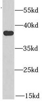 AKR1A1 Rabbit Polyclonal Antibody